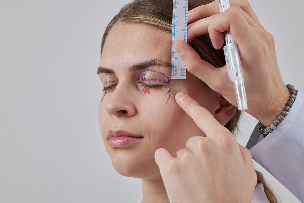 brow lift vs blepharoplasty, combined upper-face surgery, eyelid and brow